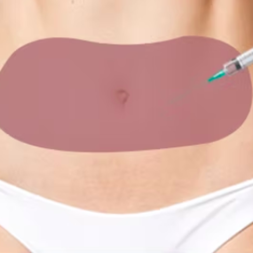 Screenshot 2024-11-18 at 09.35.38