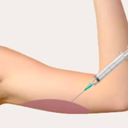 Screenshot 2024-11-18 at 09.35.54