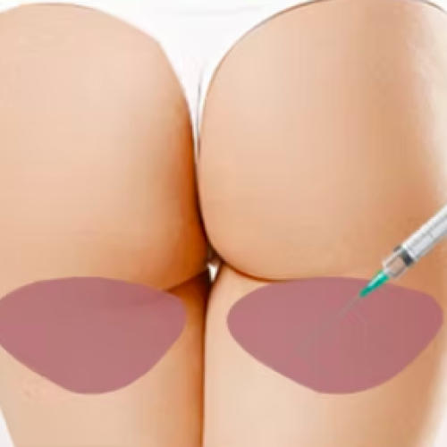 Screenshot 2024-11-18 at 09.36.09